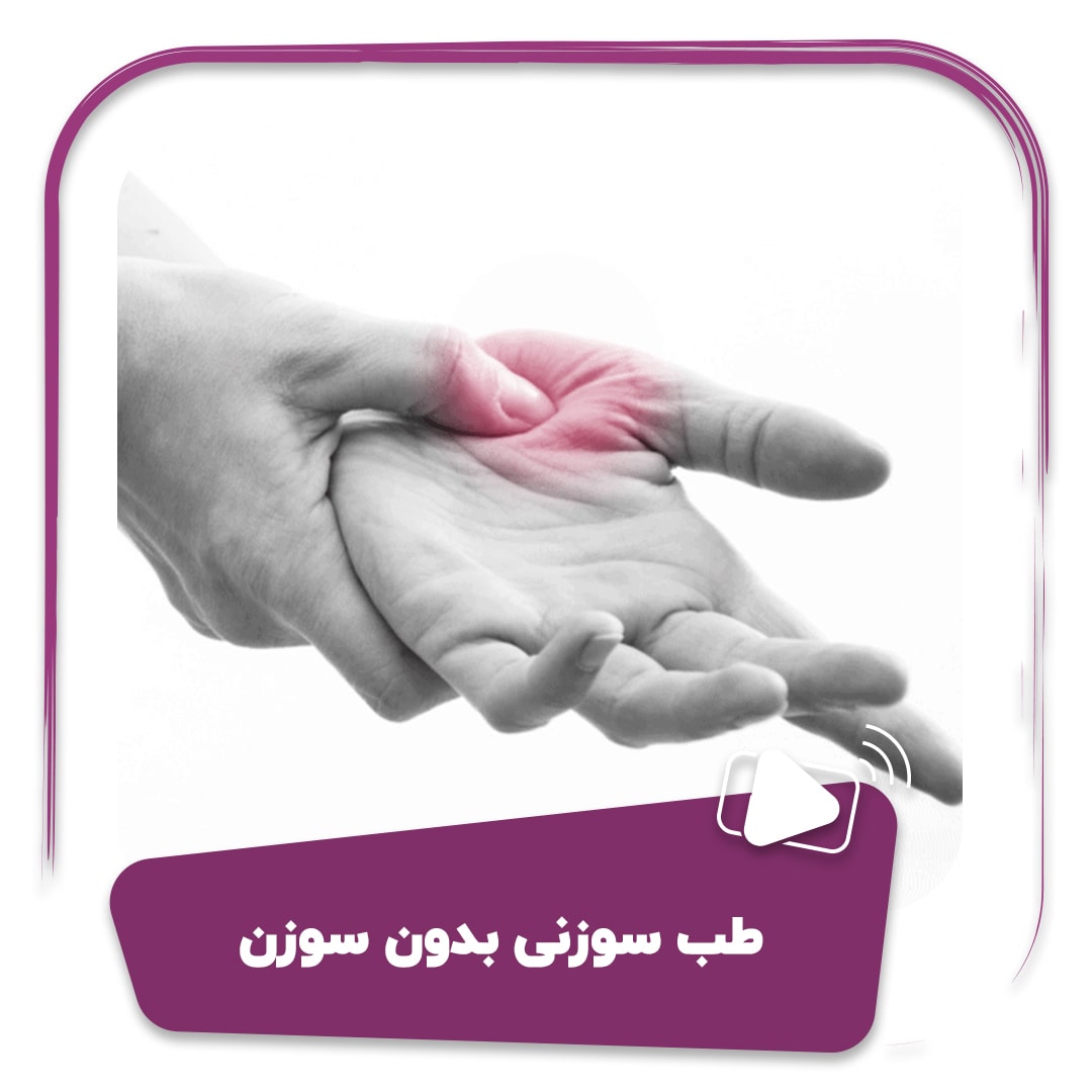 فیلم طب سوزنی بدون سوزن