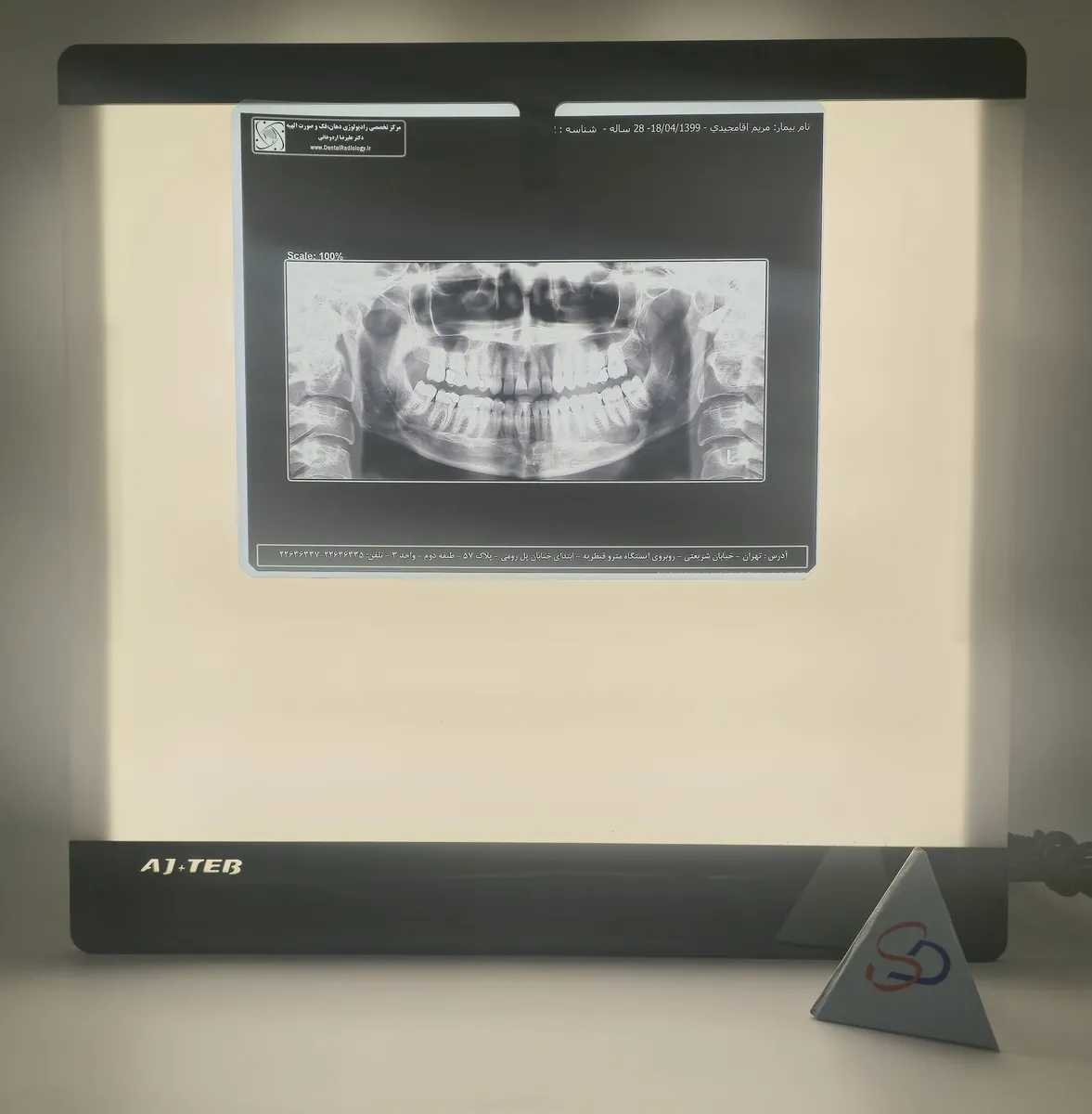 نگاتسکوپ دیجیتال عاج طب مدل CTX-PG-AT