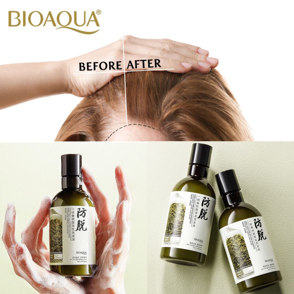 شامپو رزماری بیوآکوا BIOAQUA hair loss prevention shampoo