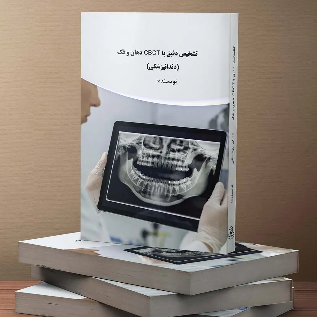 تشخیص دقیق با CBCT دهان و فک(دندانپزشکی)
