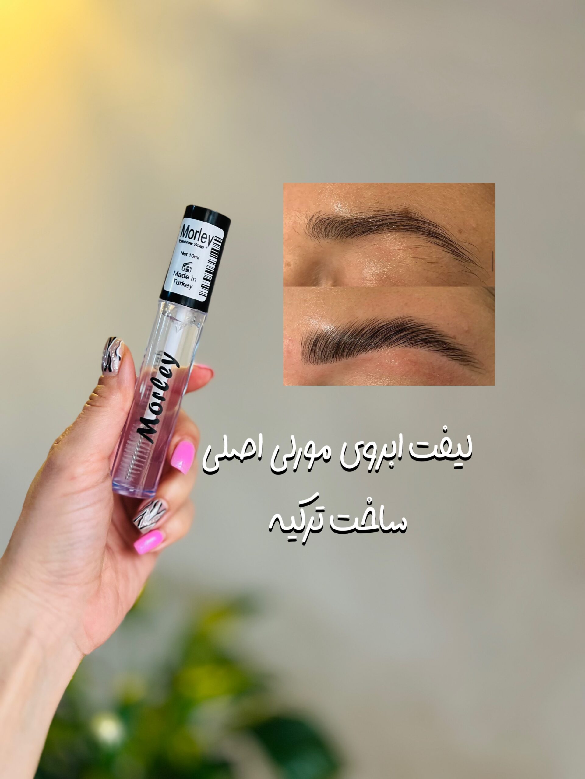 لیفت ابروی ریملی مورلی