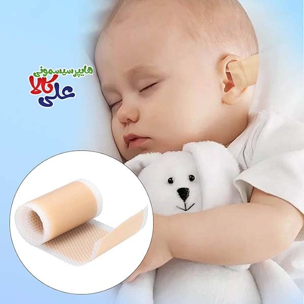 چسب اصلاح فرم گوش نوزاد