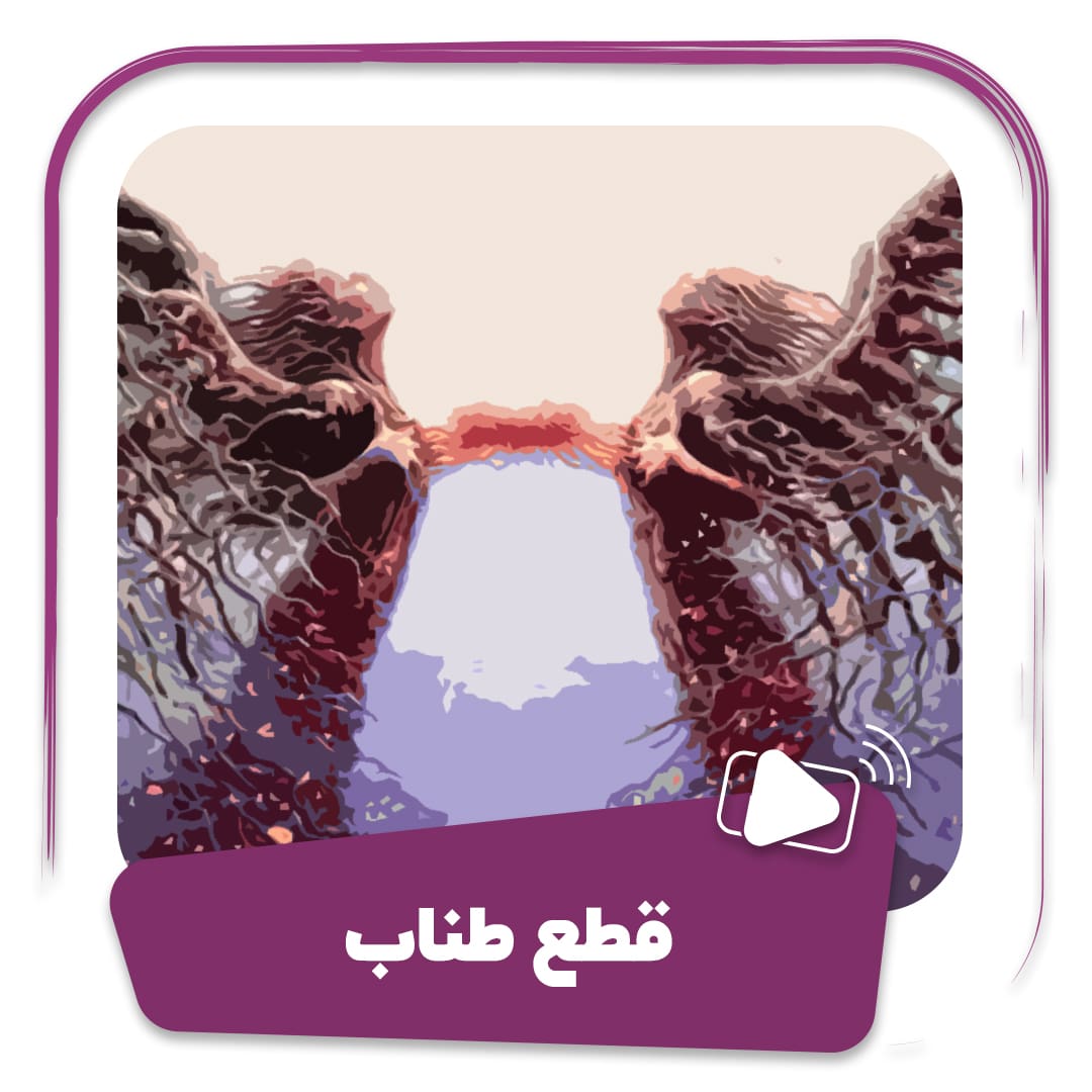 فیلم قطع طناب