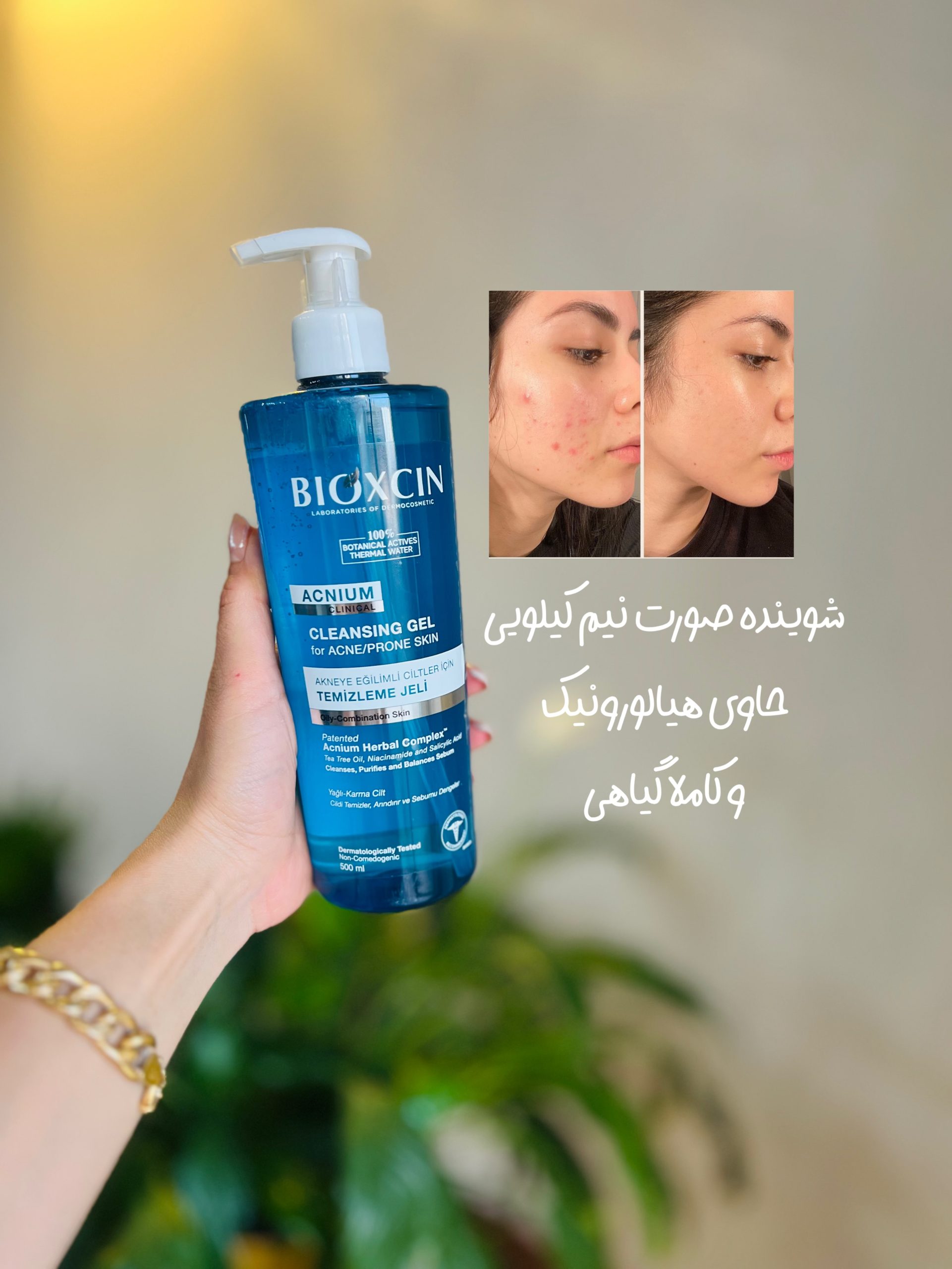 ژل شستشوی صورت ضد جوش بیوکسین 500 میل